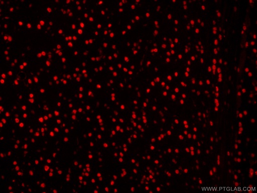 [CL594-60082-100UL] CoraLite®594-conjugated DACH1 Monoclonal antibody