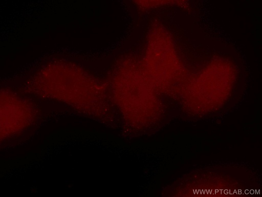 [CL594-60121-100UL] CoraLite®594-conjugated BRD8 Monoclonal antibody