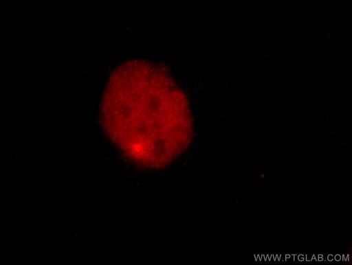 [CL594-60145-100UL] CoraLite®594-conjugated PAX8 Monoclonal antibody