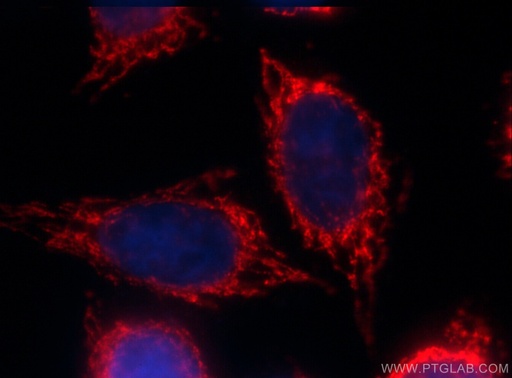 [CL594-60171-100UL] CoraLite®594-conjugated ALDH1A1 Monoclonal antibody