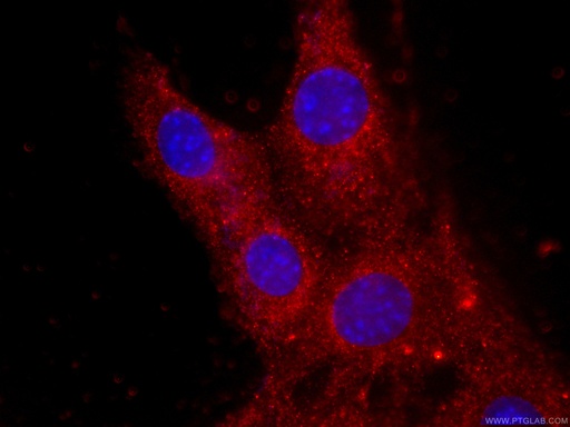 [CL594-60177-100UL] CoraLite®594-conjugated CKM-Specific Monoclonal antibody