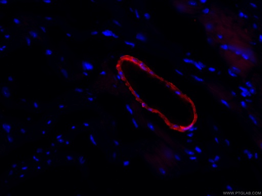 [CL594-60213-100UL] CoraLite®594-conjugated transgelin/SM22 Monoclonal antibody
