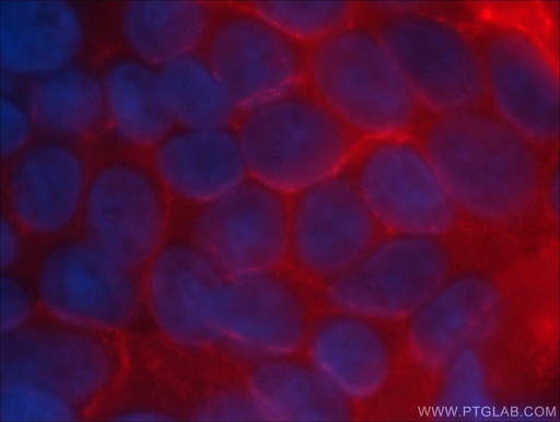 [CL594-60224-100UL] CoraLite®594-conjugated CD44 Monoclonal antibody