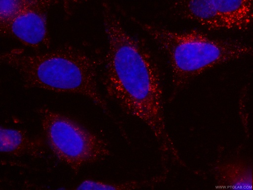 [CL594-60228-100UL] CoraLite®594-conjugated Cytoglobin Monoclonal antibody