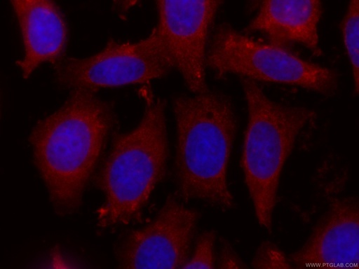 [CL594-60237-100UL] CoraLite®594-conjugated COTL1 Monoclonal antibody