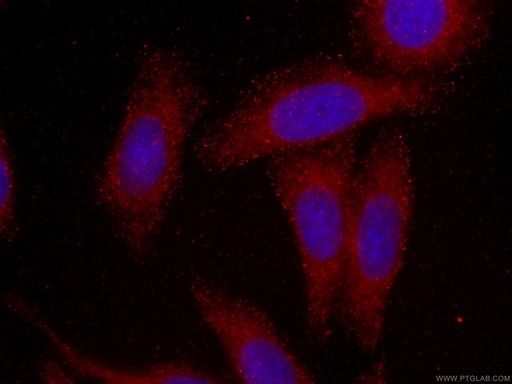 [CL594-60255-100UL] CoraLite®594-conjugated SMN-Exon7 Monoclonal antibody
