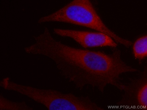 [CL594-60262-100UL] CoraLite®594-conjugated IL-1R2 Monoclonal antibody