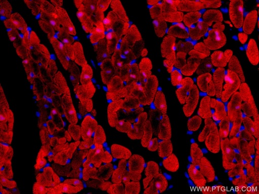 [CL594-60280-100UL] CoraLite®594-conjugated FABP3 Monoclonal antibody