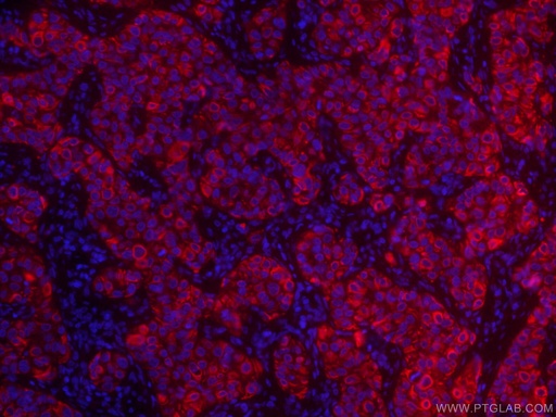[CL594-60291-100UL] CoraLite®594-conjugated TNF Alpha Monoclonal antibody