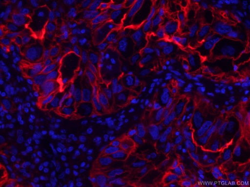 [CL594-60299-100UL] CoraLite®594-conjugated ICAM-1 Monoclonal antibody