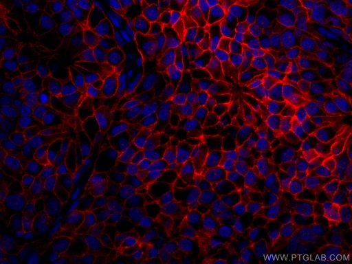 [CL594-60311-100UL] CoraLite®594-conjugated HER2/ErbB2 Monoclonal antibody