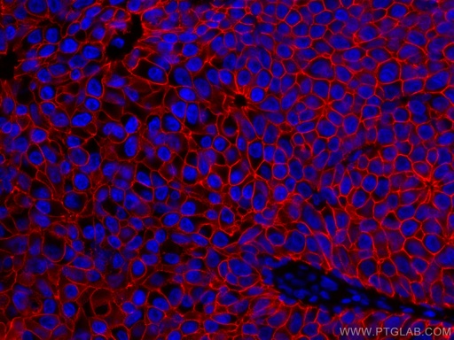 [CL594-60335-100UL] CoraLite®594-conjugated E-cadherin Monoclonal antibody