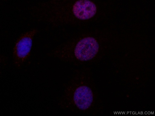 [CL594-60353-100UL] CoraLite®594-conjugated MUM1 Monoclonal antibody