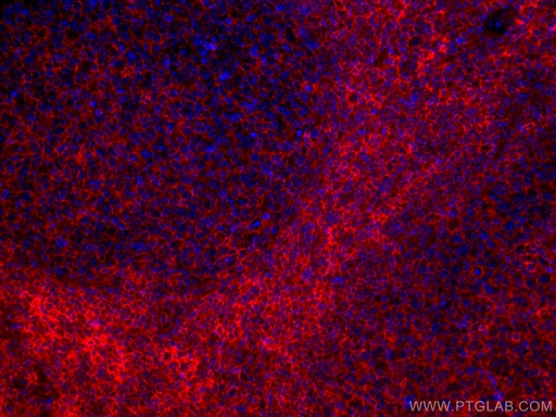 [CL594-66013-100UL] CoraLite®594-conjugated HLA class I ABC Monoclonal antibody