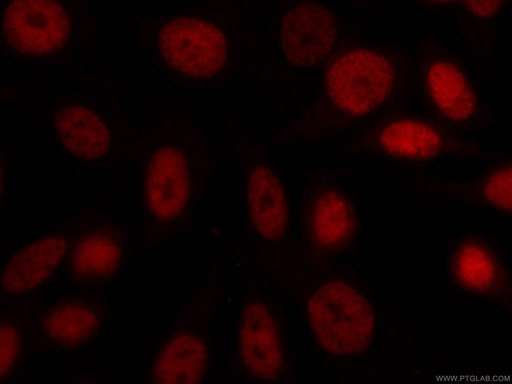 [CL594-66038-100UL] CoraLite®594-conjugated CUL4A Monoclonal antibody