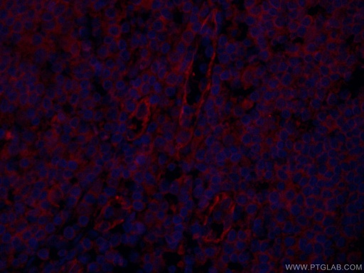 [CL594-66065-100UL] CoraLite®594-conjugated CD31 Monoclonal antibody