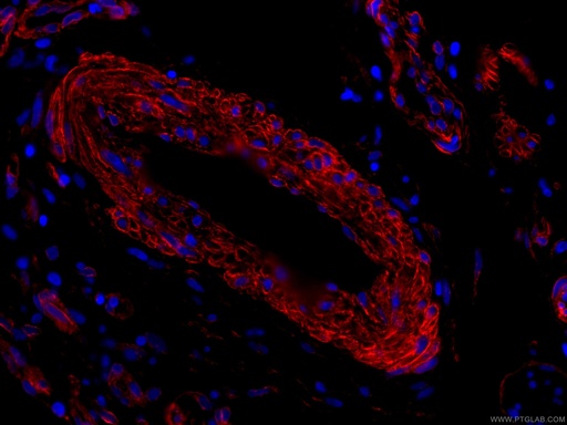 [CL594-66067-100UL] CoraLite®594-conjugated Caveolin-1 Monoclonal antibody