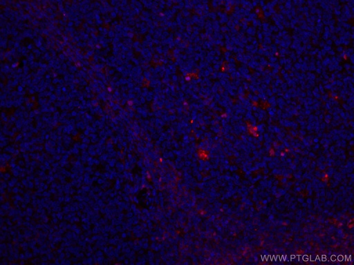 [CL594-66078-100UL] CoraLite®594-conjugated Alpha Antichymotrypsin Monoclonal antibody