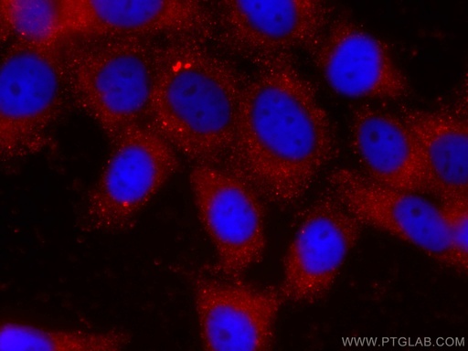 [CL594-66101-100UL] CoraLite®594-conjugated P4HA1 Monoclonal antibody