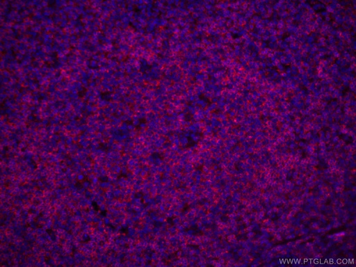 [CL594-66103-100UL] CoraLite®594-conjugated CD22 Monoclonal antibody