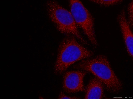 [CL594-66121-100UL] CoraLite®594-conjugated Alpha Galactosidase A Monoclonal antibody