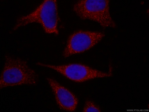 [CL594-66124-100UL] CoraLite®594-conjugated APOL1-Specific Monoclonal antibody