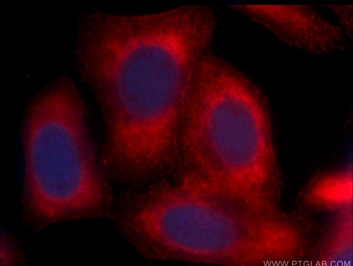 [CL594-66129-100UL] CoraLite®594-conjugated Arginase-1 Monoclonal antibody