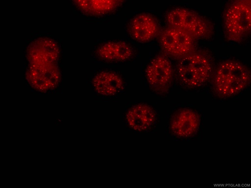 [CL594-66179-100UL] CoraLite®594-conjugated PSMD4 Monoclonal antibody