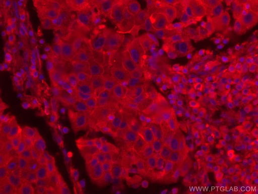 [CL594-66180-100UL] CoraLite®594-conjugated CD71 Monoclonal antibody
