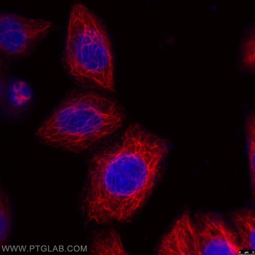 [CL594-66187-100UL] CoraLite®594-conjugated KRT18 Monoclonal antibody