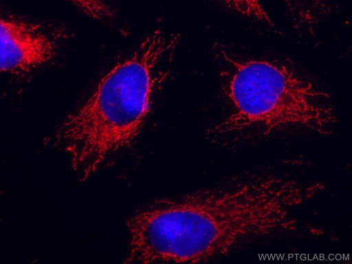 [CL594-66191-100UL] CoraLite®594-conjugated VAPB Monoclonal antibody