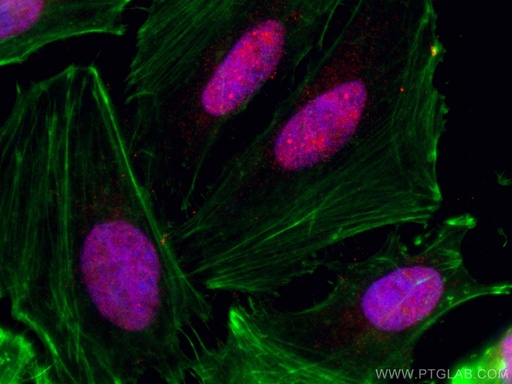 [CL594-66222-100UL] CoraLite®594-conjugated CHD4 Monoclonal antibody