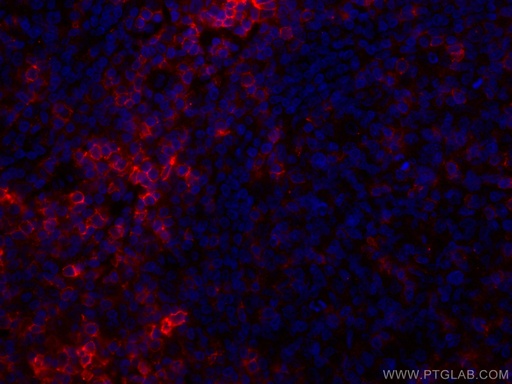 [CL594-66224-100UL] CoraLite®594-conjugated CD43 Monoclonal antibody