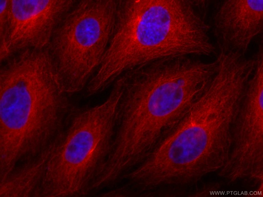 [CL594-66240-100UL] CoraLite®594-conjugated Beta Tubulin Monoclonal antibody