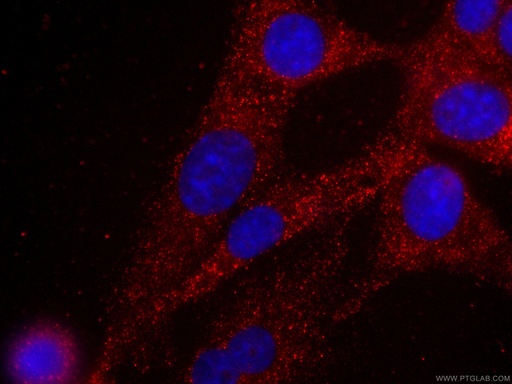 [CL594-66286-100UL] CoraLite®594-conjugated MYL3 Monoclonal antibody