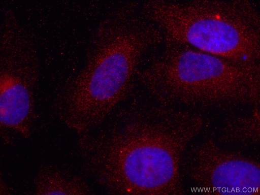 [CL594-66297-100UL] CoraLite®594-conjugated Sestrin 2 Monoclonal antibody