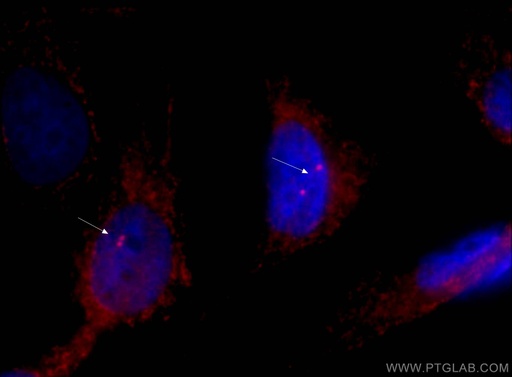 [CL594-66320-100UL] CoraLite®594-conjugated Gamma Tubulin Monoclonal antibody
