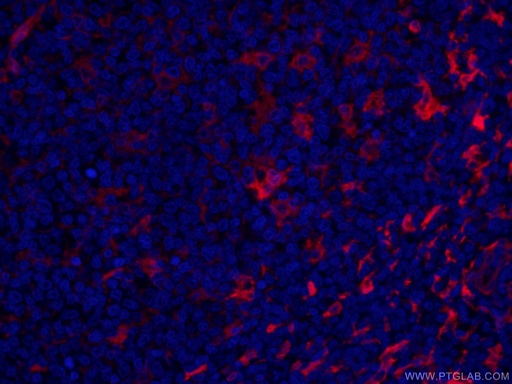 [CL594-66321-100UL] CoraLite®594-conjugated Fascin Monoclonal antibody