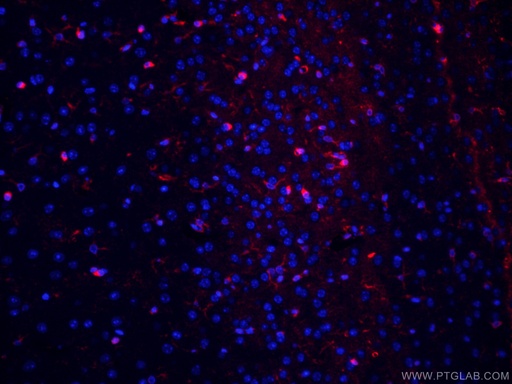 [CL594-66323-100UL] CoraLite®594-conjugated Glutamine Synthetase Monoclonal antibody