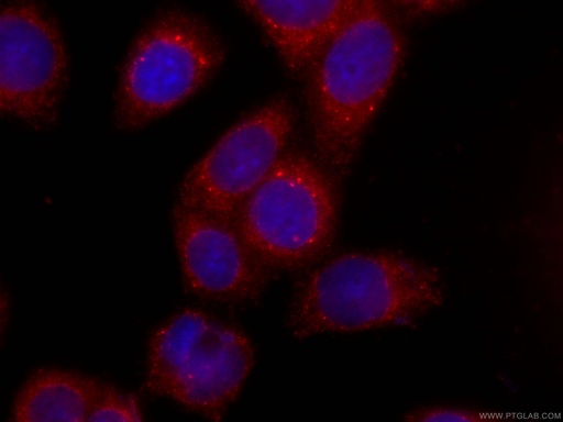 [CL594-66365-100UL] CoraLite®594-conjugated ERp72 Monoclonal antibody