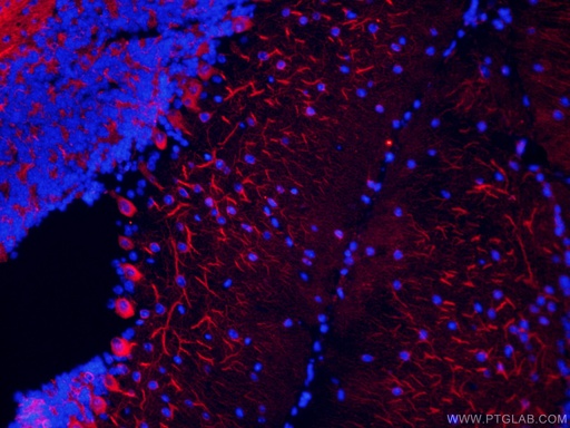 [CL594-66375-100UL] CoraLite®594-conjugated TUBB3-specific Monoclonal antibody