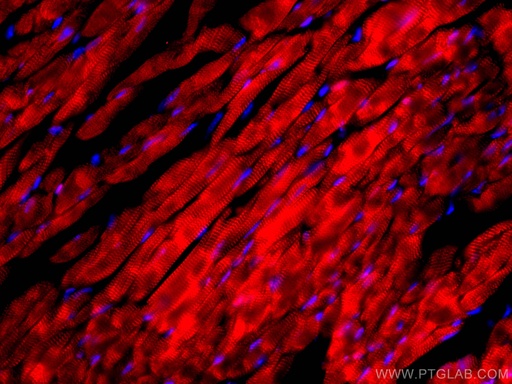 [CL594-66376-100UL] CoraLite®594-conjugated Cardiac Troponin I Monoclonal antibody
