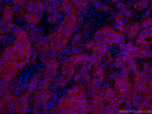 [CL594-66386-100UL] CoraLite®594-conjugated PADI2 Monoclonal antibody