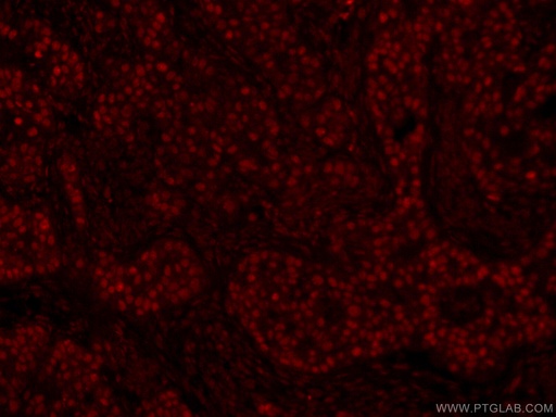 [CL594-66400-100UL] CoraLite®594-conjugated GATA3 Monoclonal antibody