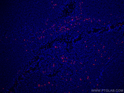 [CL594-66408-100UL] CoraLite®594-conjugated Human IgG4 Monoclonal antibody