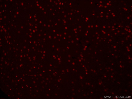 [CL594-66411-100UL] CoraLite®594-conjugated SOX2 Monoclonal antibody