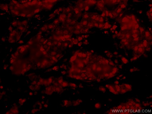 [CL594-66490-100UL] CoraLite®594-conjugated HRPT2; CDC73 Monoclonal antibody