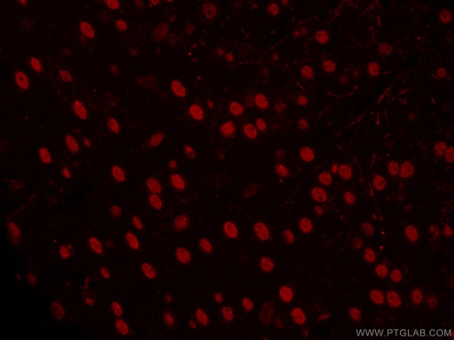 [CL594-66564-100UL] CoraLite®594-conjugated TBR1 Monoclonal antibody