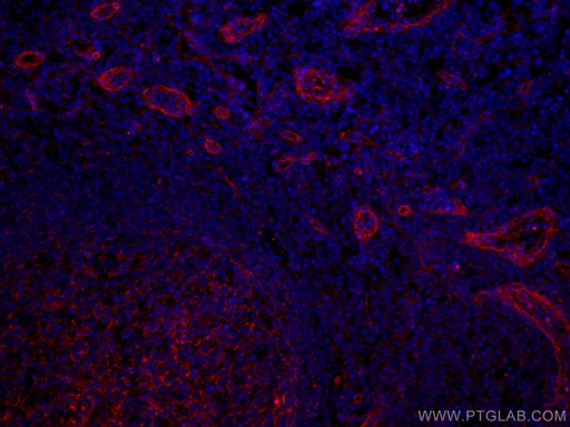 [CL594-66567-100UL] CoraLite®594-conjugated CD151 Monoclonal antibody