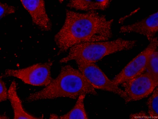 [CL594-66624-100UL] CoraLite®594-conjugated GSTA1 Monoclonal antibody